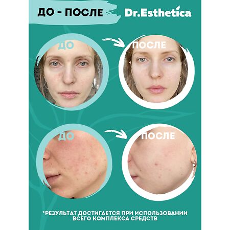 Dr. Esthetica\Доктор Эстетика Пенка для умывания лица от прыщей очищающий уход 200 мл 1 шт