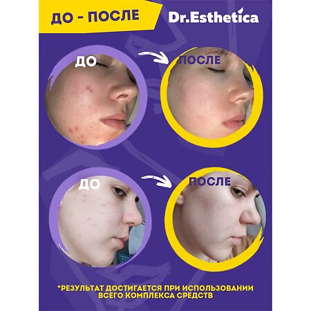 Dr. Esthetica\Доктор Эстетика Гель-крем для лица от прыщей для подростков уход за проблемной кожей 20 мл 20 мл 1 шт